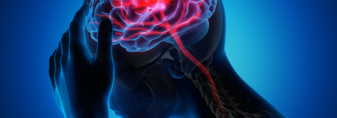 migraine headache pain