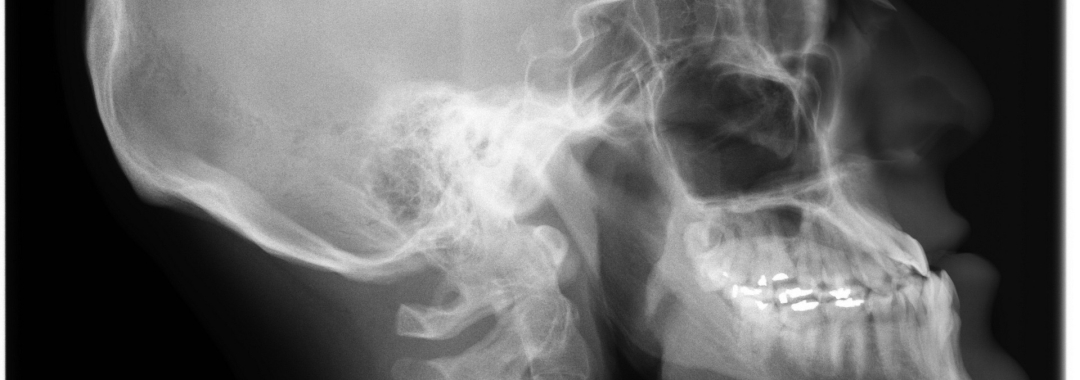 neck x rays
